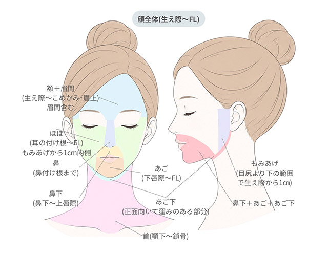 脱毛（女性）脱毛範囲表-顔