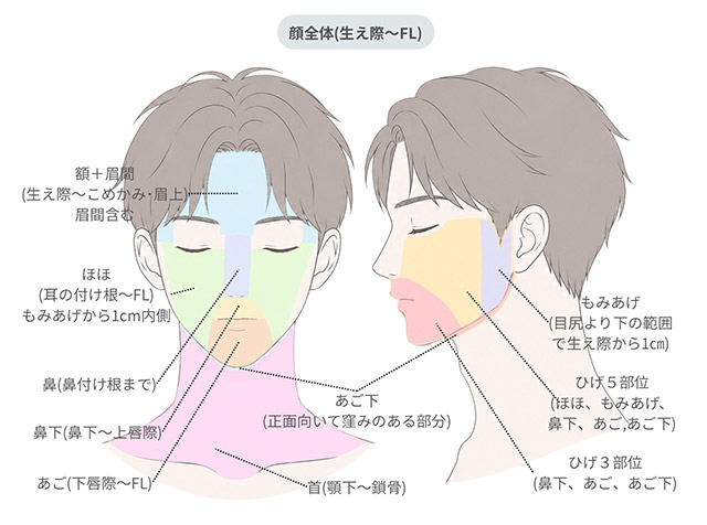 脱毛範囲表-顔